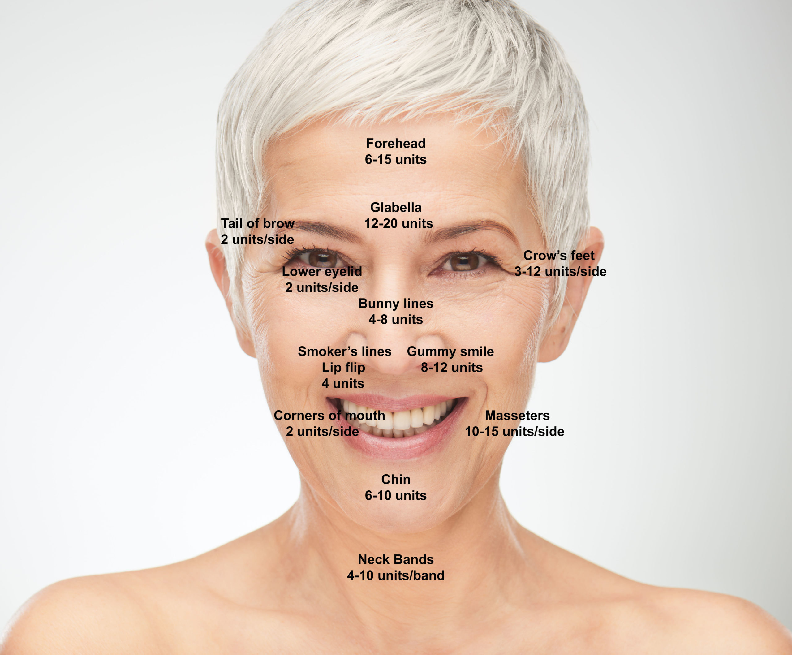 Botox used to treat in the face