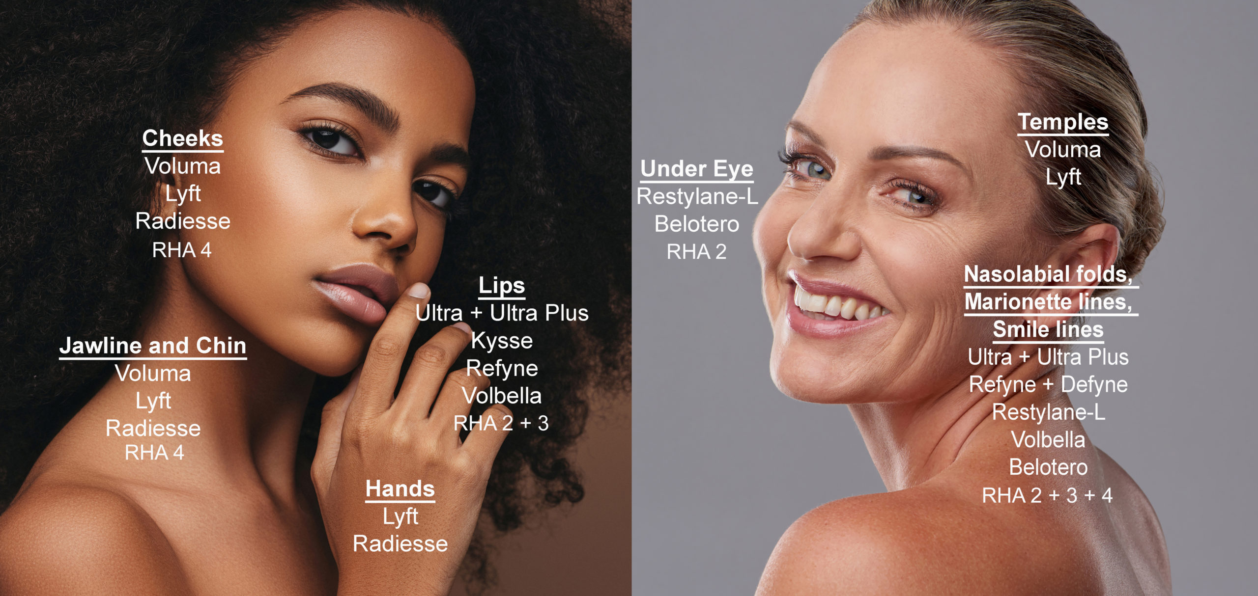 Dermal Fillers Diagram