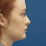 443502340-gmrightlateral-web-2