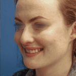443502342-gmleftoblique2-smiling-web-2