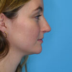 HMrightlateral(web) copy
