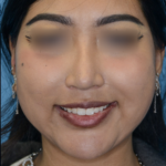 KTfrontal2(web) copy