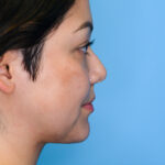 ASrightlateral(web) copy