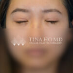 SLfrontal2(web) copy