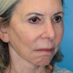 JMfacelift_rightoblique(web) copy