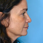 KMrightlateral(web) copy