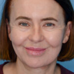 MBfrontal2(web) copy