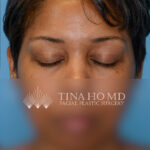 KBfrontal2(web) copy