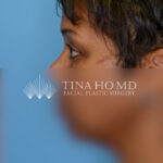 KBleftlateral(web) copy