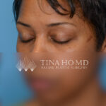 KBleftoblique2(web) copy