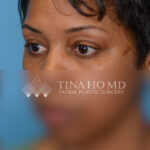 KBleftoblique(web) copy