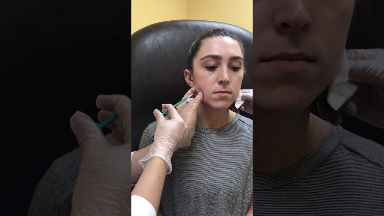 Neurotoxin Masseter Injection with Dr. Tina Ho