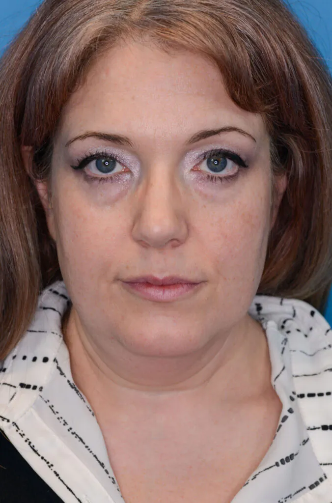 Woman looks forward in a headshot against a blue background.