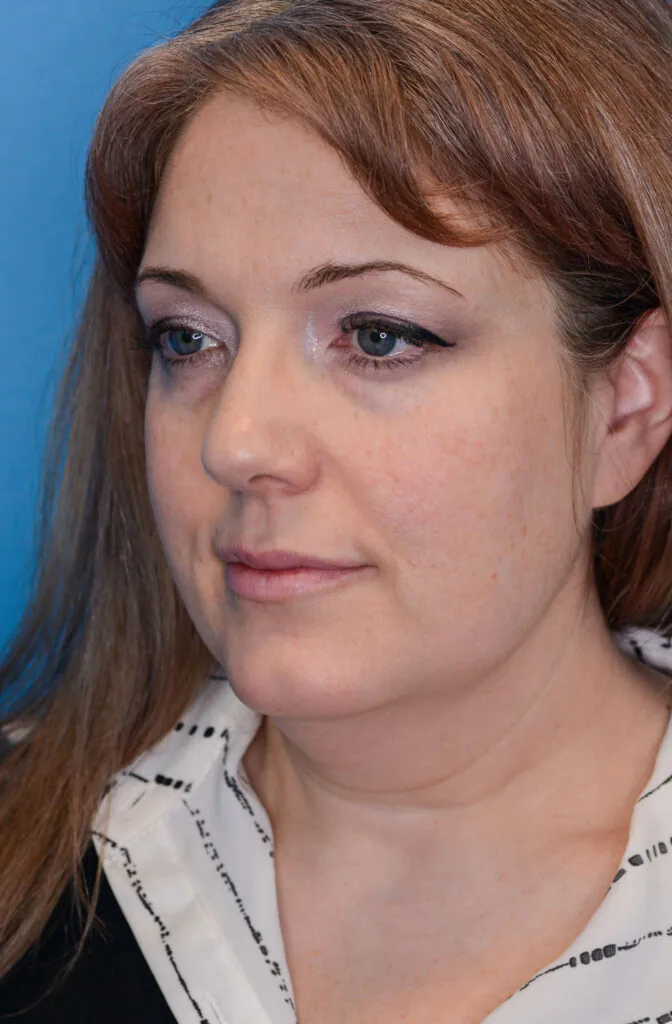 Woman faces left against a blue background.