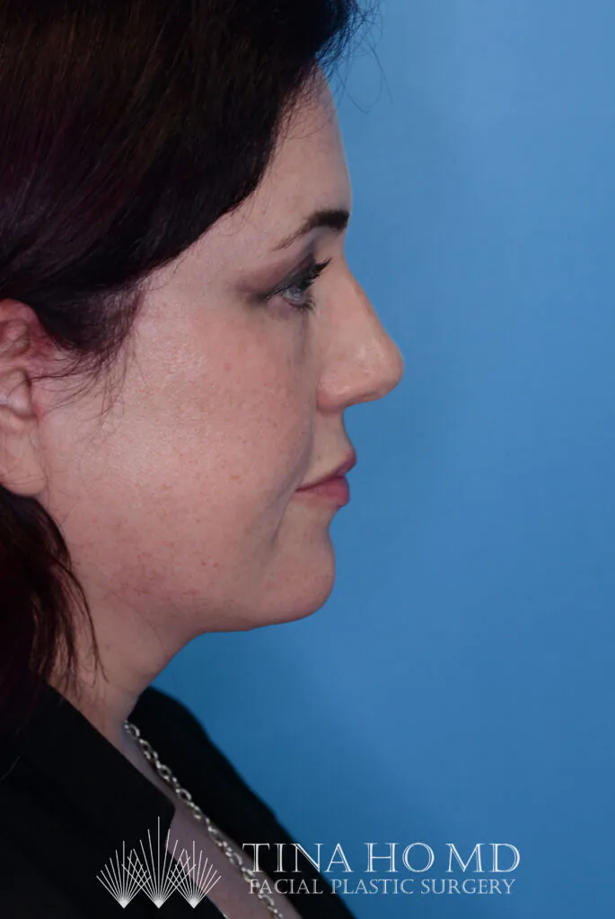 Woman’s face in side profile against a blue background.
