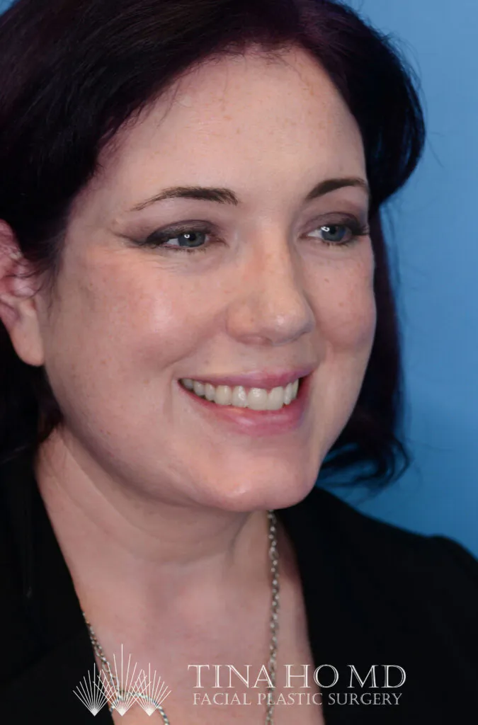 Smiling woman looks to the side in a portrait studio.