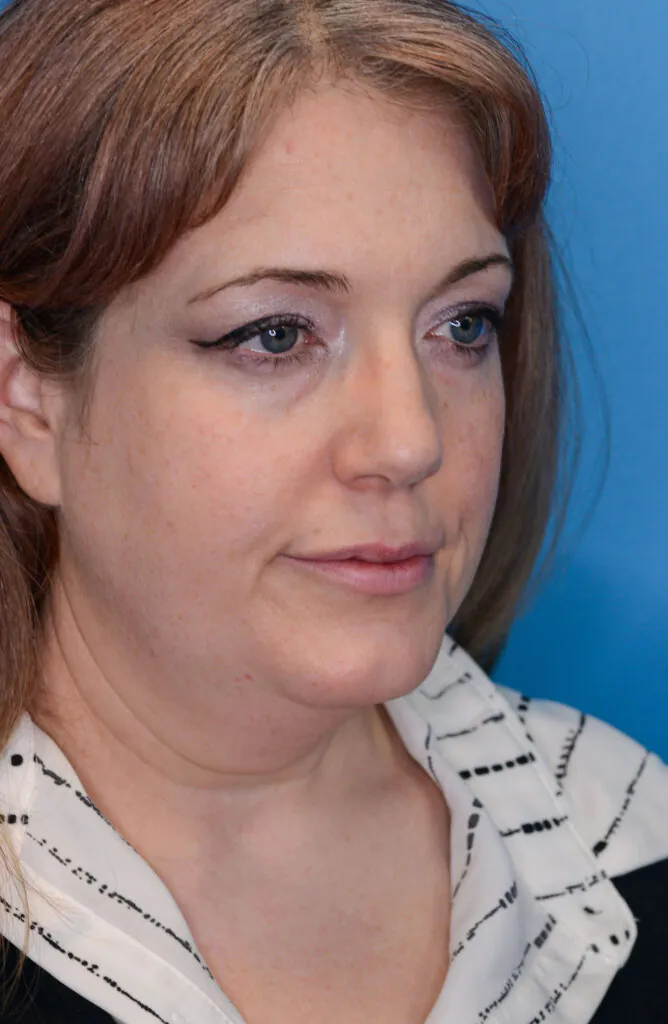 Woman looks to the side against a blue background.